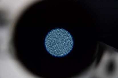 Una célula sana vista desde el microscopio.