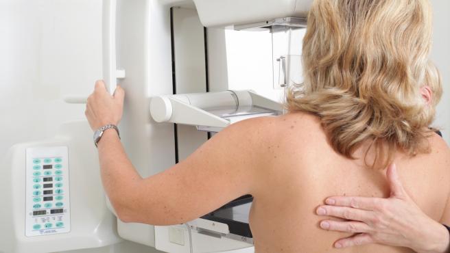 Archivo - Arxiu - Imatge de recurs d'una mamografia.